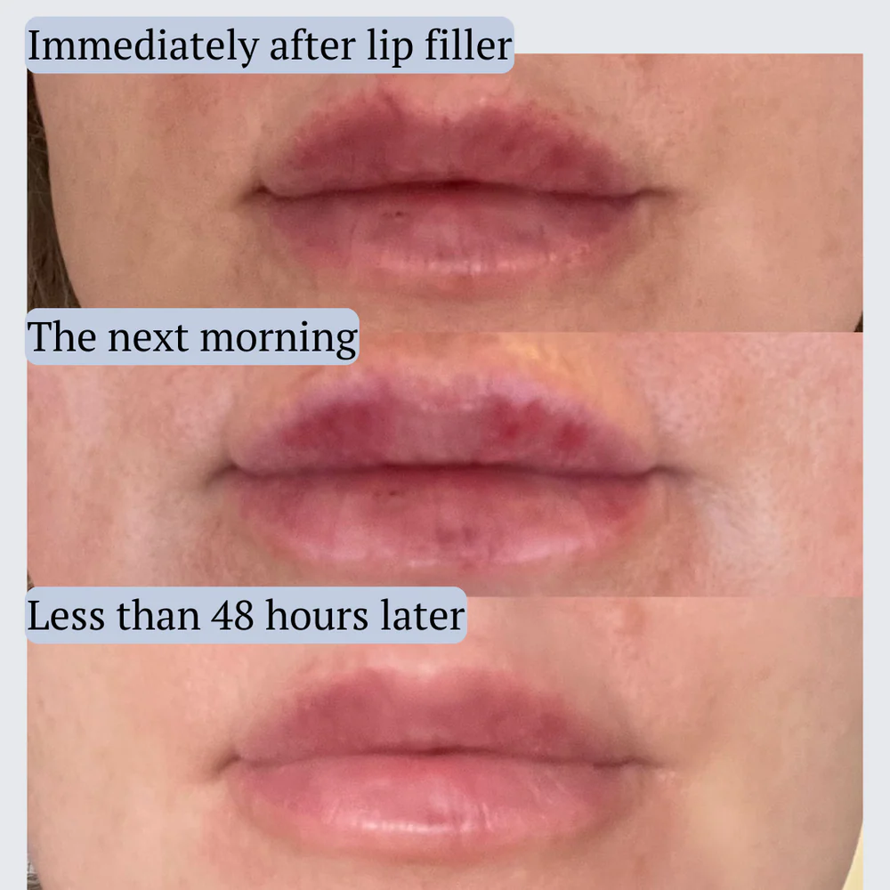 AfterMED LIPS - Image 4