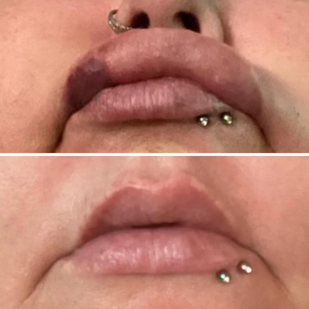 AfterMED LIPS - Image 5