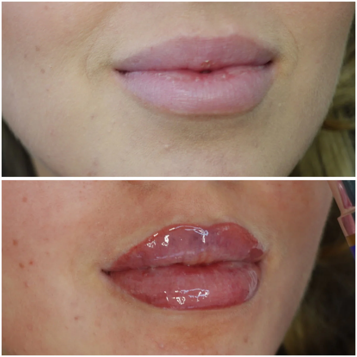 AfterMED LIPS - Image 6