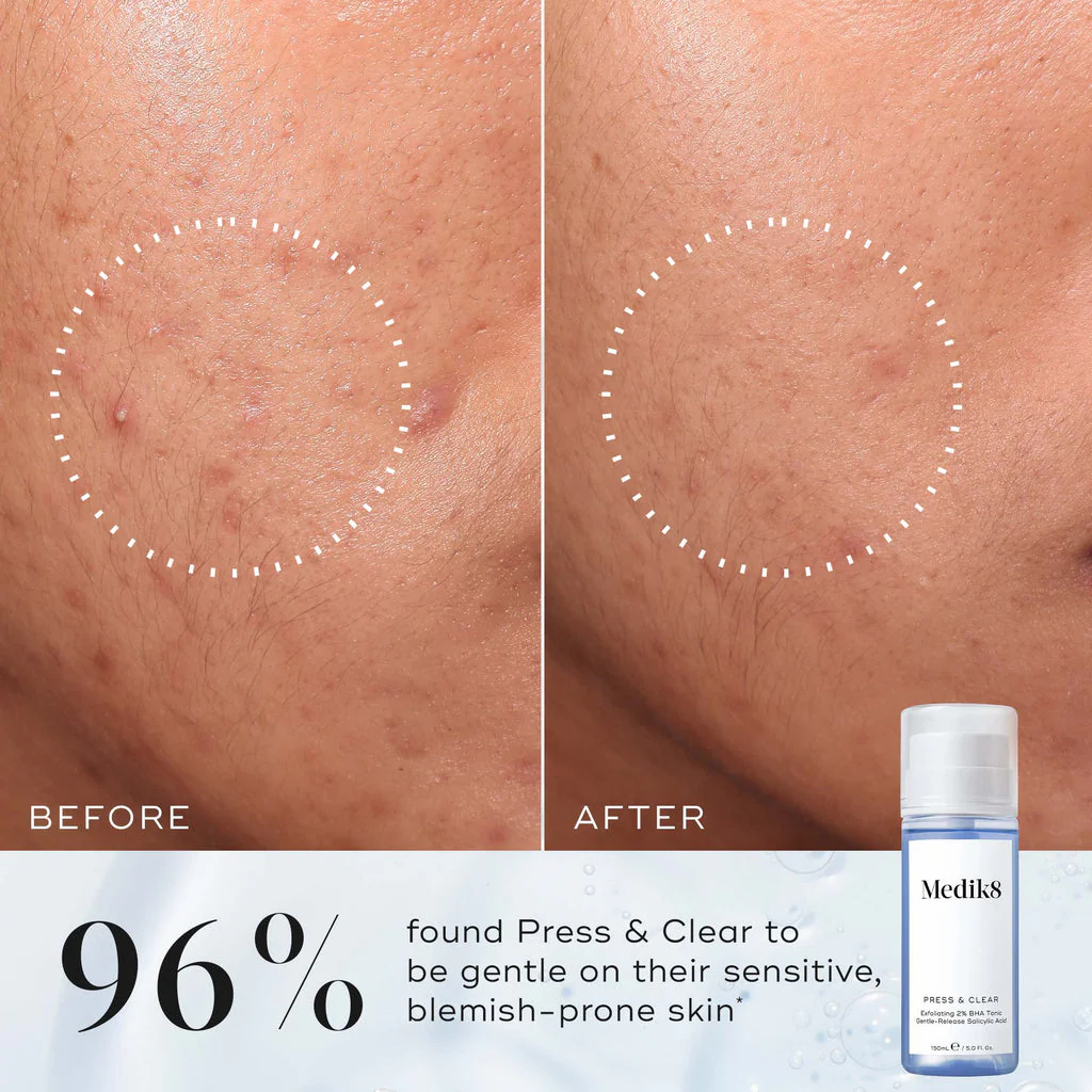 MEDIK8 PRESS & CLEAR™ 200ml - Image 3